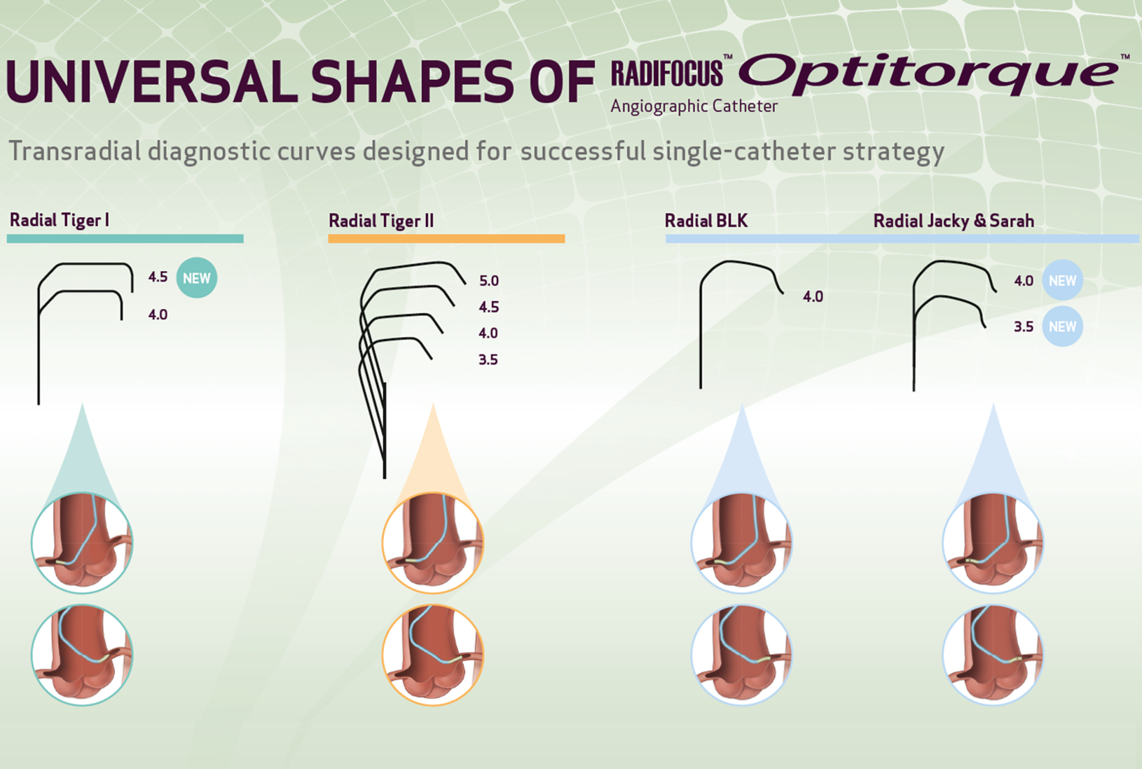 Radifocus™ Optitorque™ Angiographic catheter